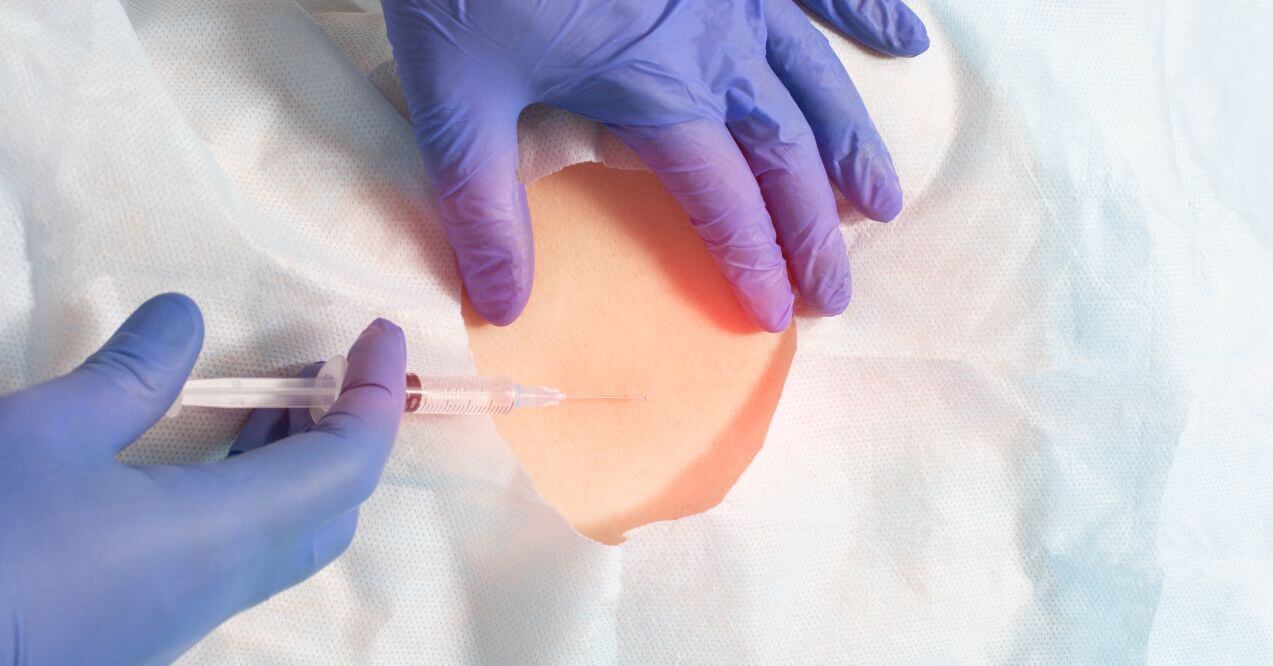 Doctor holding epidural syringe with clear liquid