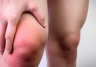 Swollen and inflamed knee area possibly indicating lymph nodes behind the knee.